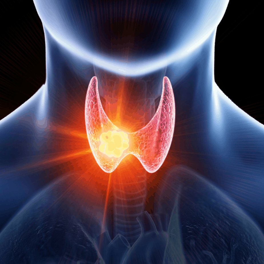 THE TRUTH ABOUT BREAD, BROMINES, IODINE DEFICIENCY, AND YOUR THYROID